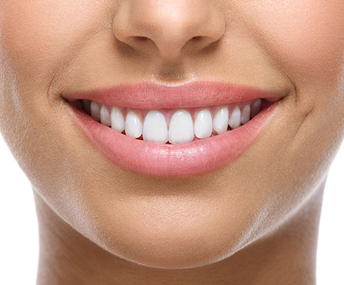 gleam smile 01